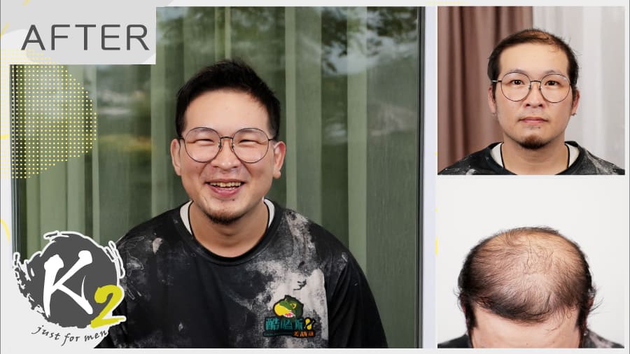 重新照鏡子的那一天，他笑得像高中時的自己