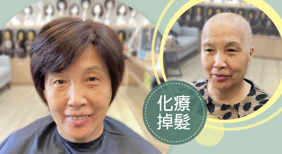 一頂醫療假髮，重拾走出家門的勇氣