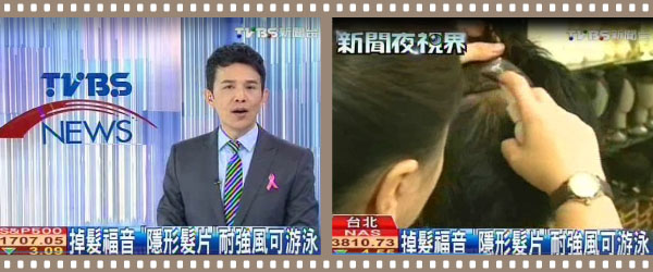 TVBS: Hair system is able to exposes the hairline